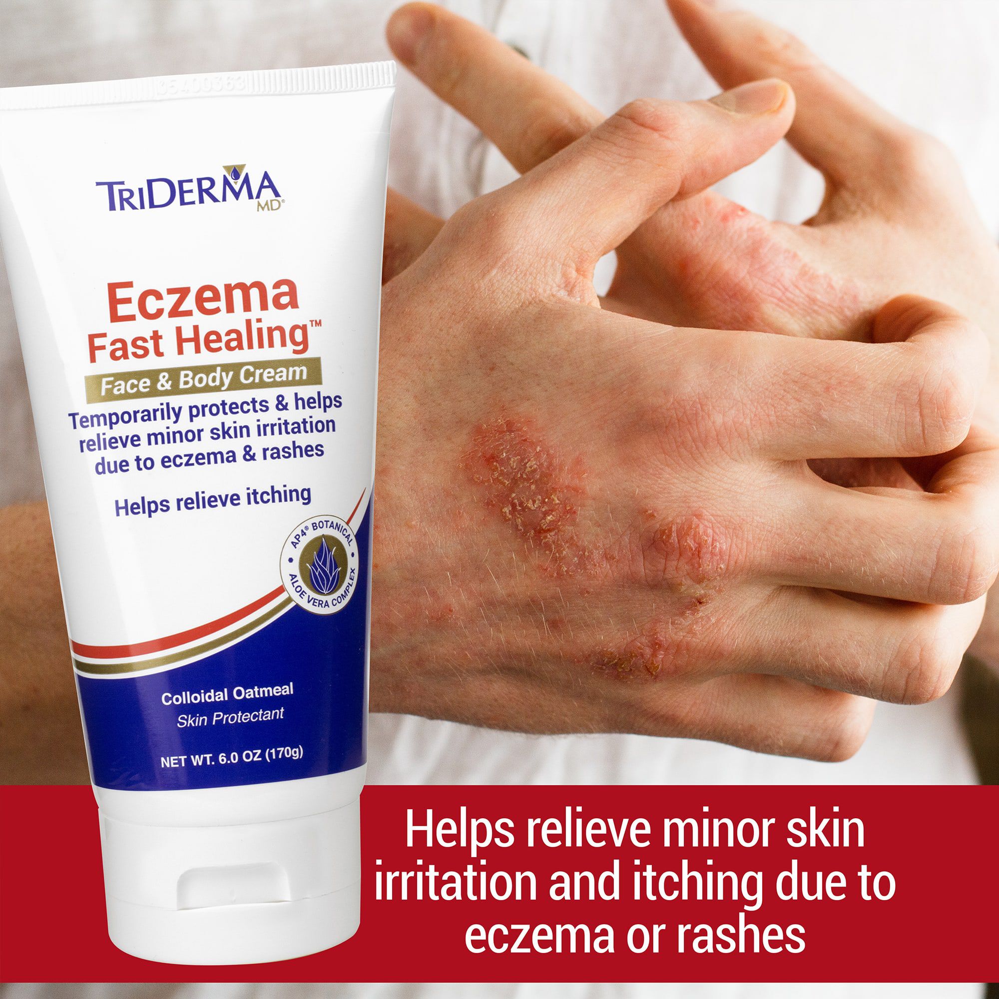 TriDerma Eczema Fast Healing™ Face & Body Cream, 6 oz. Tube, , large
