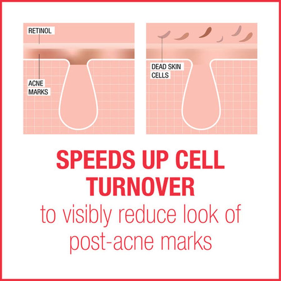 Neutrogena Stubborn Marks PM Treatment, 1 oz., , large image number 2